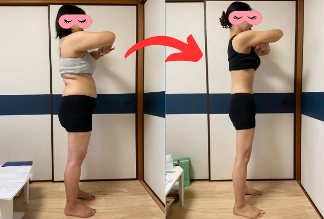 耳つぼダイエット ビフォーアフター