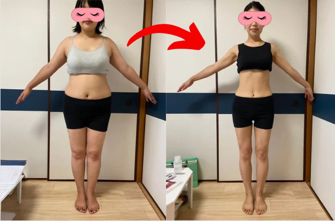 耳つぼダイエットビフォーアフター