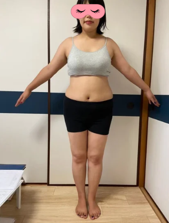 耳つぼダイエット 耳つぼダイエット ビフォー