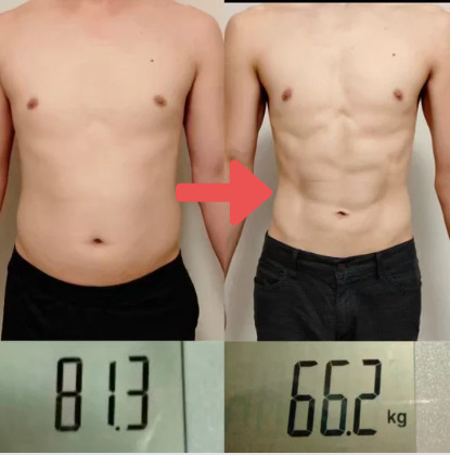 耳つぼダイエット ビフォーアフター